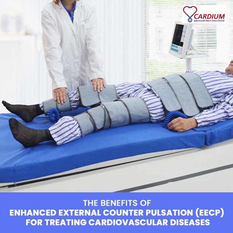 The Benefits of Enhanced External Counter Pulsation (EECP) for Treating Cardiovascular Diseases