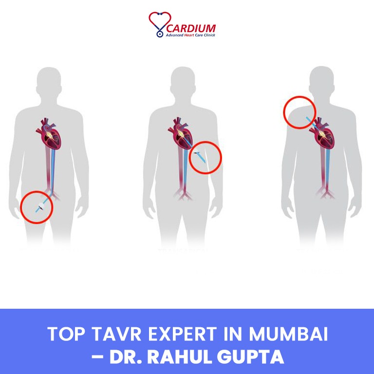 Cardium Advanced Health Care Clinic | Heart Hospital In Mumbai